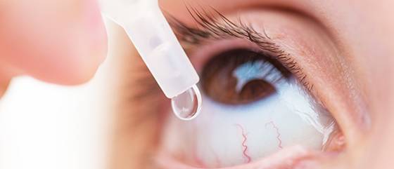 Irriterte øyne kan ofte være tegn på allergi